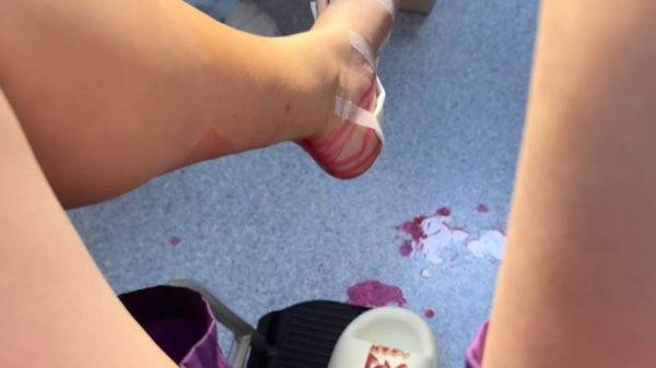 富盈策略 月瘦20斤、助眠解压……指压板成网红健身器材，医生：这几类人不能踩